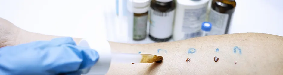 Alerji Tedavi ve Takip Aşamaları